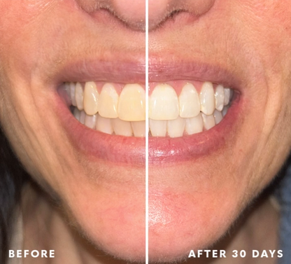 SEAGRIL® Bestsellers THE EASIEST WAY TO WHITEN YOUR TEETH