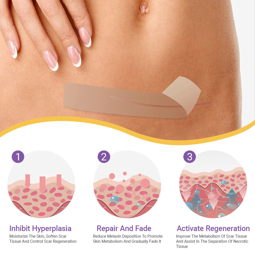 ✨ SEAGRIL® Official – Clinically Proven Scar & Skin Repair Tape Fade old scars, restore smoothness, and rebuild confidence — trusted by dermatologists.