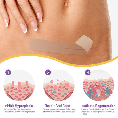 ✨ SEAGRIL® Official – Clinically Proven Scar & Skin Repair Tape Fade old scars, restore smoothness, and rebuild confidence — trusted by dermatologists.