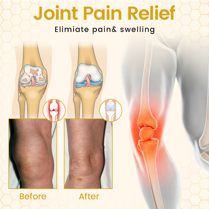 SEAGRIL® VenomFlex Bee Therapy Cream