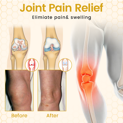 SEAGRIL® VenomFlex Bee Therapy Cream