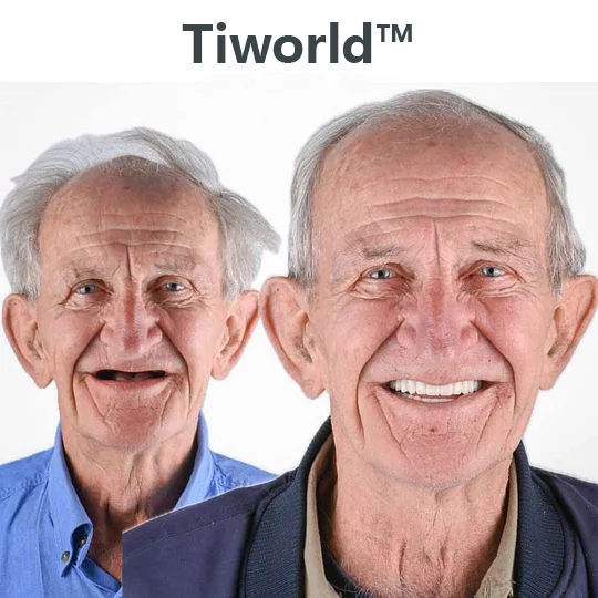 😁 Ends Today: 70% OFF! Tiworld™ Custom-Fit Full Functional DenturesMake you more confident – Made in the USA & FDA-Certified