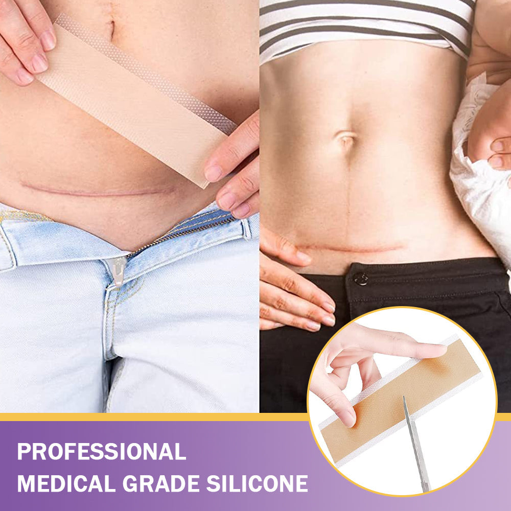 ✨ SEAGRIL® Official – Clinically Proven Scar & Skin Repair Tape Fade old scars, restore smoothness, and rebuild confidence — trusted by dermatologists.